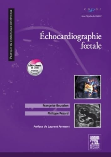 Echocardiographie foetale Echocardiographie foetale von Elsevier Masson