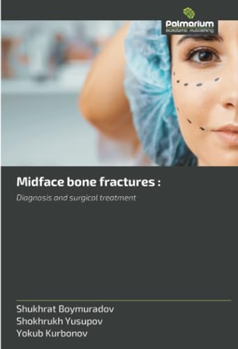 Midface bone fractures :: Diagnosis and surgical treatment von Palmarium Academic Publishing