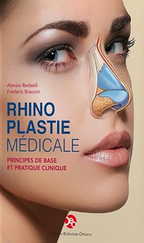 Rhinoplastie médicale. Principes de base et pratique clinique Rhinoplastie médicale. Principes de base et pratique clinique von OEO