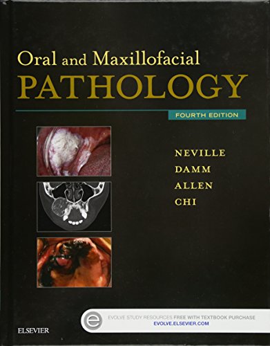 Oral and Maxillofacial Pathology von Saunders