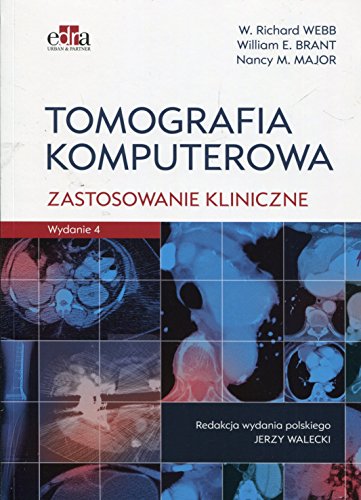 Tomografia komputerowa Zastosowanie kliniczne Tomografia komputerowa Zastosowanie kliniczne von Edra Urban & Partner