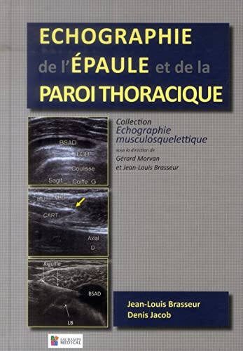 ECHOGRAPHIE DE L'EPAULE ET DE LA PAROI THORACIQUE von SAURAMPS MEDICA
