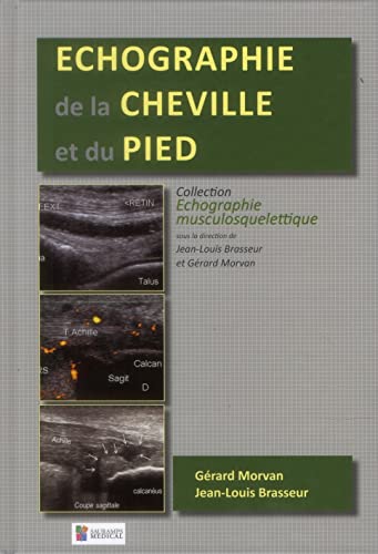 ECHOGRAPHIE DE LA CHEVILLE ET DU PIED