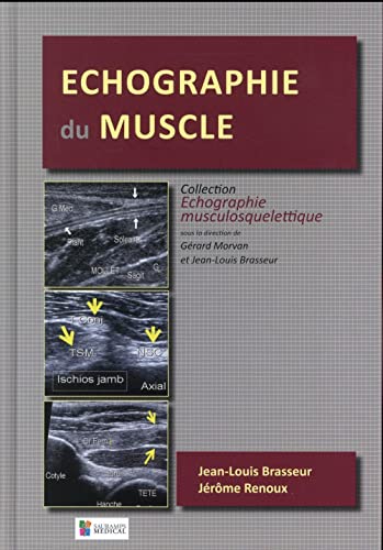 Echographie Du Muscle von SAURAMPS MEDICA