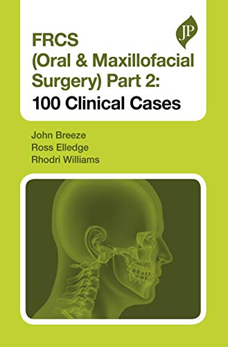 FRCS (Oral & Maxillofacial Surgery): 100 Clinical Cases (Postgraduate)