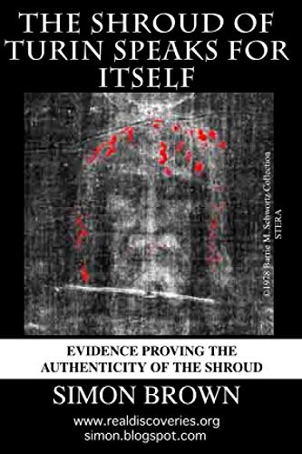 The Shroud of Turin Speaks for Itself