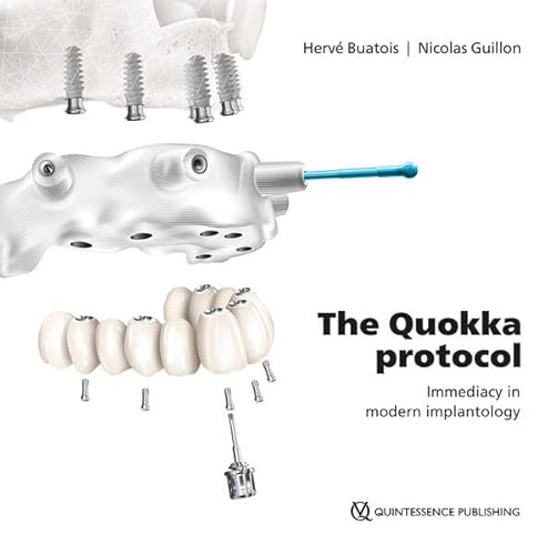 The Quokka protocol: Immediacy in modern implantology von Quintessence Publishing