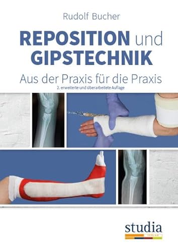 Reposition und Gipstechnik II: Aus der Praxis für die Praxis