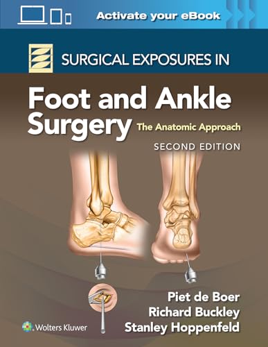 Surgical Exposures in Foot and Ankle Surgery: The Anatomic Approach von Lippincott Williams&Wilki
