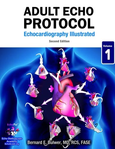 Adult Echo Protocol - Second Edition (Echocardiography Illustrated, Band 1)