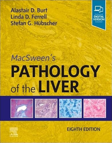 MacSween's Pathology of the Liver von Elsevier