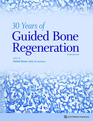 30 Years of Guided Bone Regeneration von Quintessence Publishing