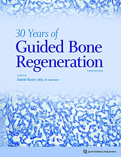 30 Years of Guided Bone Regeneration