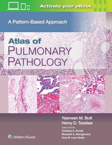 Atlas of Pulmonary Pathology: A Pattern Based Approach von LWW