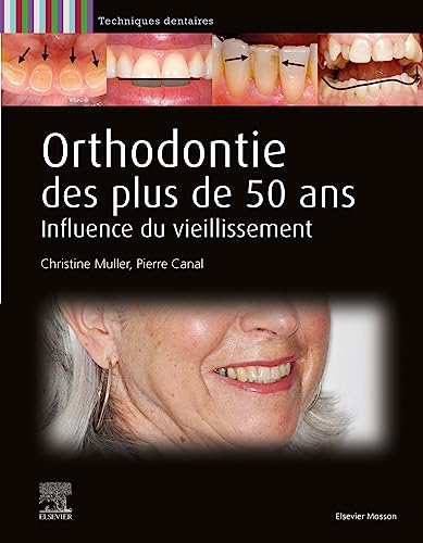 Orthodontie des plus de 50 ans: Influence du vieillissement Orthodontie des plus de 50 ans: Influence du vieillissement