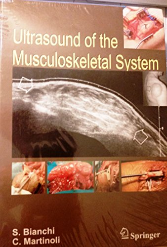 ULTRASOUND OF THE MUSCULOSKELETAL SYSTEM