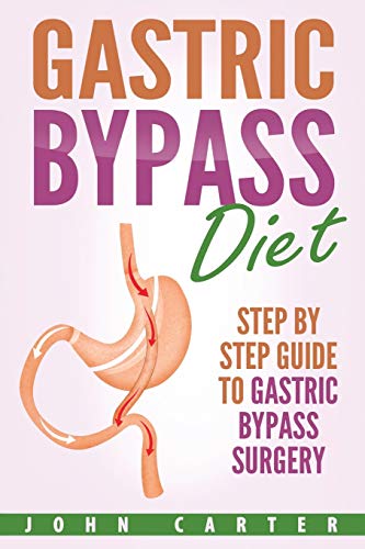 Gastric Bypass Diet: Step By Step Guide to Gastric Bypass Surgery (Bariatric Cookbook, Band 2)