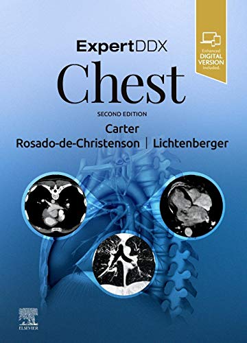 ExpertDDx: Chest von Elsevier