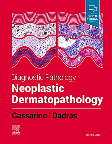 Diagnostic Pathology: Neoplastic Dermatopathology Diagnostic Pathology: Neoplastic Dermatopathology von Elsevier