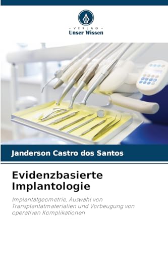 Evidenzbasierte Implantologie: Implantatgeometrie, Auswahl von Transplantatmaterialien und Vorbeugung von operativen Komplikationen von Verlag Unser Wissen