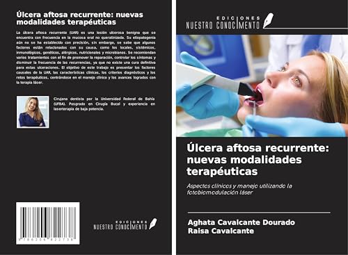 Úlcera aftosa recurrente: nuevas modalidades terapéuticas: Aspectos clínicos y manejo utilizando la fotobiomodulación láser von Ediciones Nuestro Conocimiento