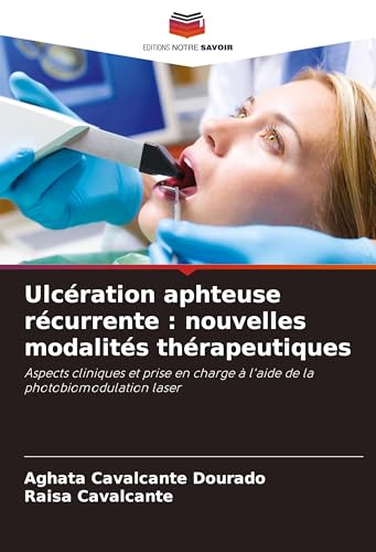 Ulcération aphteuse récurrente : nouvelles modalités thérapeutiques: Aspects cliniques et prise en charge à l'aide de la photobiomodulation laser von Editions Notre Savoir
