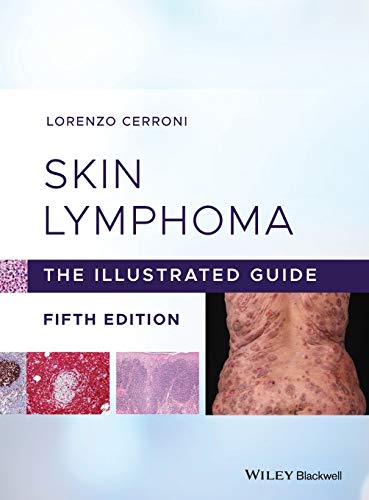 Skin Lymphoma: The Illustrated Guide von Wiley-Blackwell