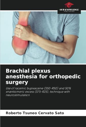 Brachial plexus anesthesia for orthopedic surgery: Use of racemic bupivacaine (S50-R50) and 50% enantiomeric excess (S75-R25), technique with neurostimulation