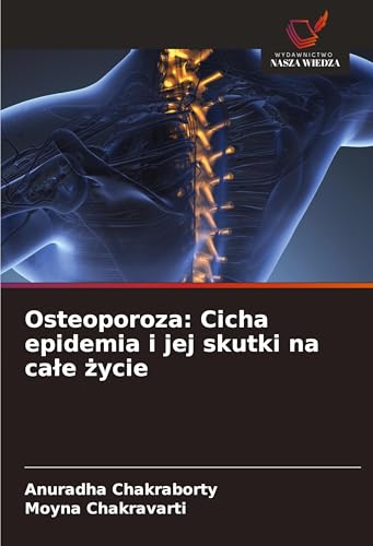 Osteoporoza: Cicha epidemia i jej skutki na ca¿e ¿ycie von Wydawnictwo Nasza Wiedza