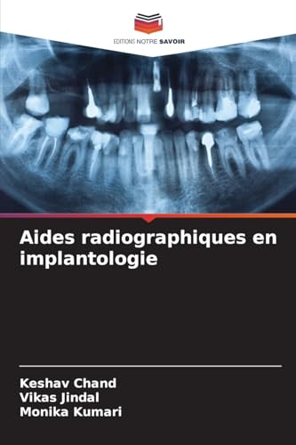 Aides radiographiques en implantologie von Editions Notre Savoir