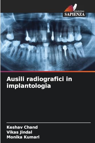 Ausili radiografici in implantologia: DE von Edizioni Sapienza