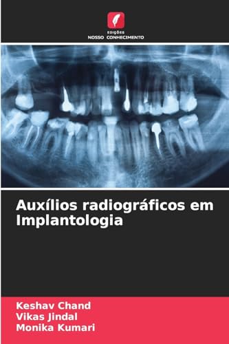 Auxílios radiográficos em Implantologia: DE von Edições Nosso Conhecimento