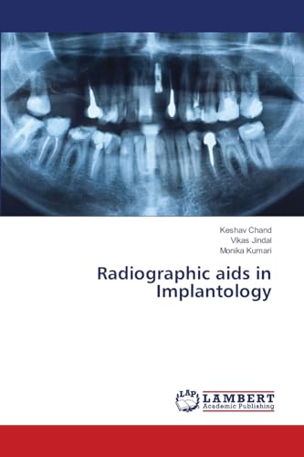 Radiographic aids in Implantology: DE von LAP LAMBERT Academic Publishing