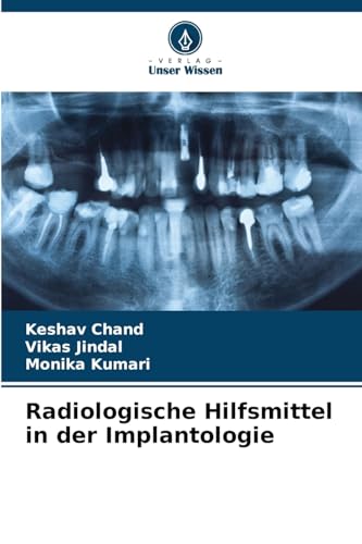 Radiologische Hilfsmittel in der Implantologie von Verlag Unser Wissen
