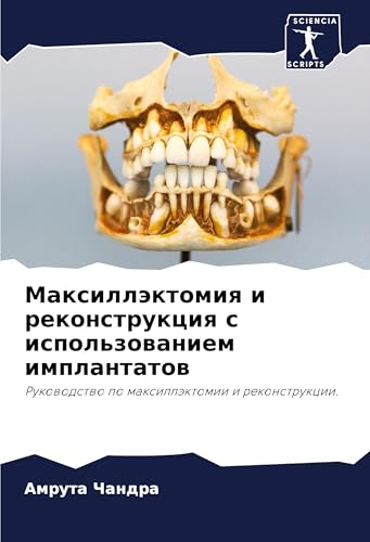 Maxilläktomiq i rekonstrukciq s ispol'zowaniem implantatow: Rukowodstwo po maxilläktomii i rekonstrukcii. von Sciencia Scripts