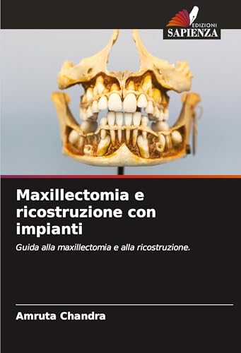 Maxillectomia e ricostruzione con impianti: Guida alla maxillectomia e alla ricostruzione. von Edizioni Sapienza