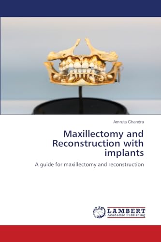 Maxillectomy and Reconstruction with implants: A guide for maxillectomy and reconstruction von LAP LAMBERT Academic Publishing