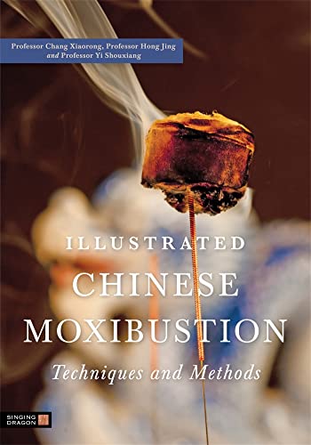 Illustrated Chinese Moxibustion Techniques and Methods von Singing Dragon