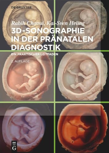 3D-Sonographie in der pränatalen Diagnostik: Ein praktischer Leitfaden