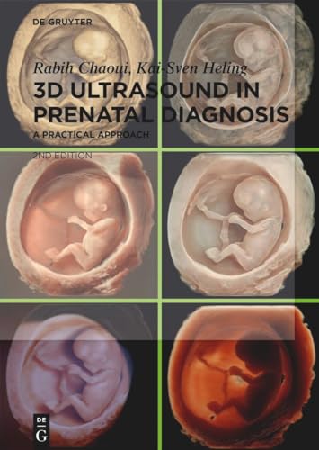 3D Ultrasound in Prenatal Diagnosis: A Practical Approach von de Gruyter