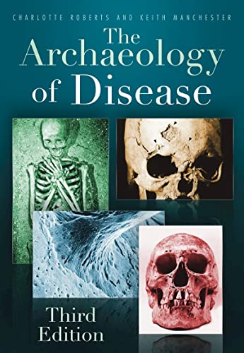 The Archaeology of Disease: Third Edition von The History Press