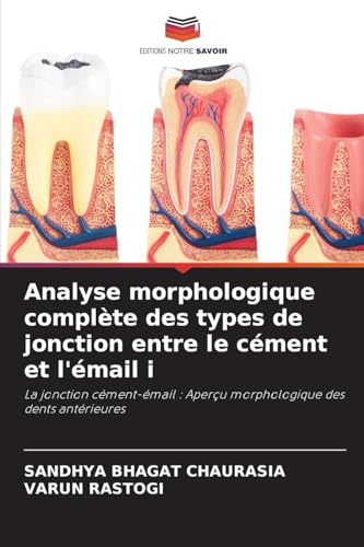 Analyse morphologique complète des types de jonction entre le cément et l'émail i: La jonction cément-émail : Aperçu morphologique des dents antérieures