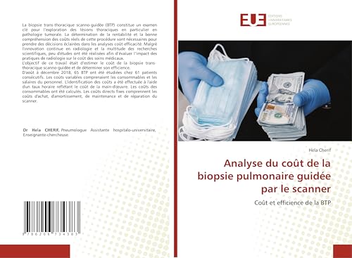 Analyse du coût de la biopsie pulmonaire guidée par le scanner: Coût et efficience de la BTP von Éditions universitaires européennes