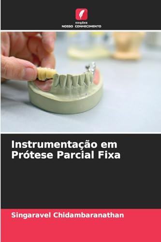Instrumentação em Prótese Parcial Fixa: DE von Edições Nosso Conhecimento