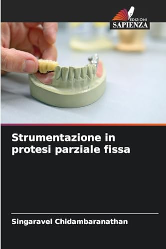 Strumentazione in protesi parziale fissa: DE von Edizioni Sapienza