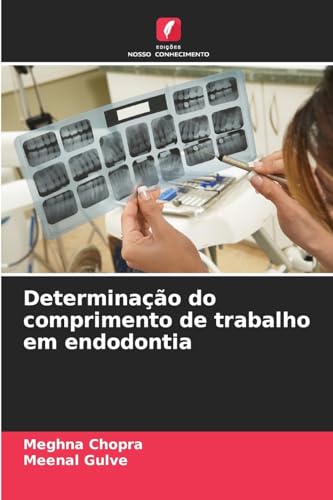 Determinação do comprimento de trabalho em endodontia von Edições Nosso Conhecimento