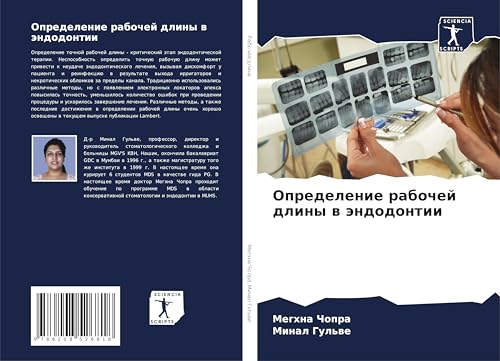 Opredelenie rabochej dliny w ändodontii von Sciencia Scripts