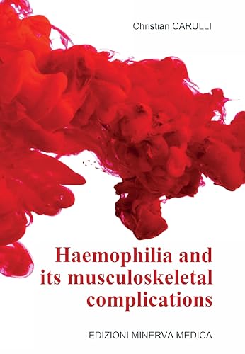Haemophilia and its musculoskeletal complications von Edizioni Minerva Medica