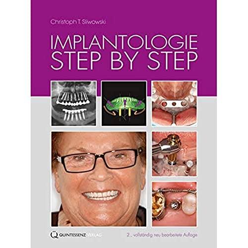 Implantologie Step by Step von Quintessenz Verlag