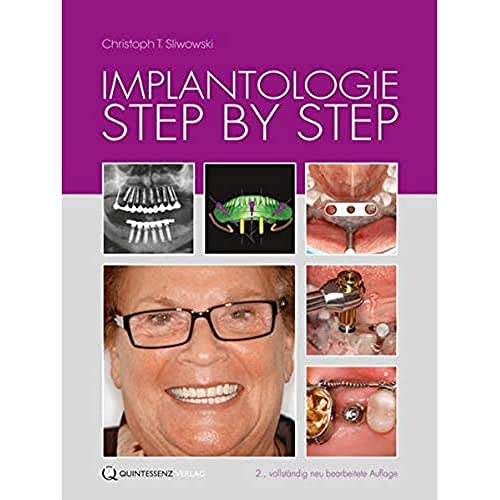 Implantologie Step by Step Implantologie Step by Step von Quintessenz Verlag